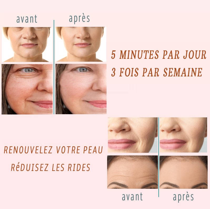 DermaLift Pro 4en1 - Lifting Intelligent Visage & Cou