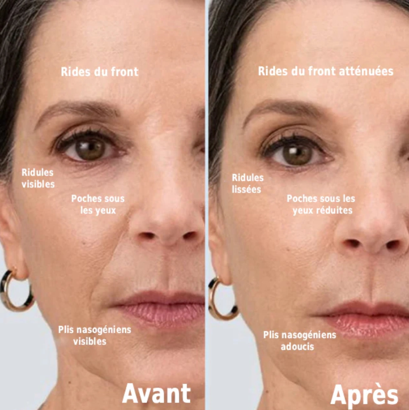 DermaSculpt™ 5en1 – Soin du Visage Professionnel à Domicile
